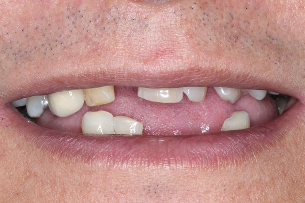 before restorative dentistry